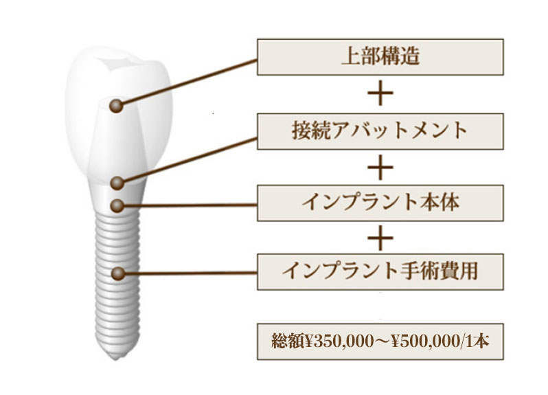 春日井市八光町・ももはな歯科クリニック・インプラント費用